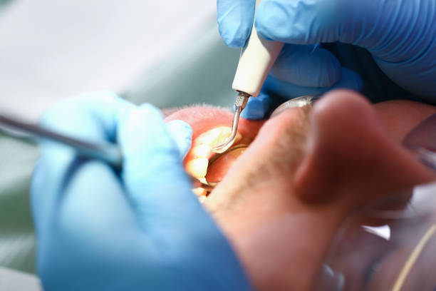 Best Emergency Dental Care for Broken or Chipped Teeth in Kaneohe, HI