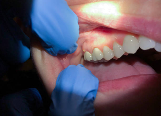 Best Urgent Care for Lost Fillings or Crowns in Kaneohe, HI